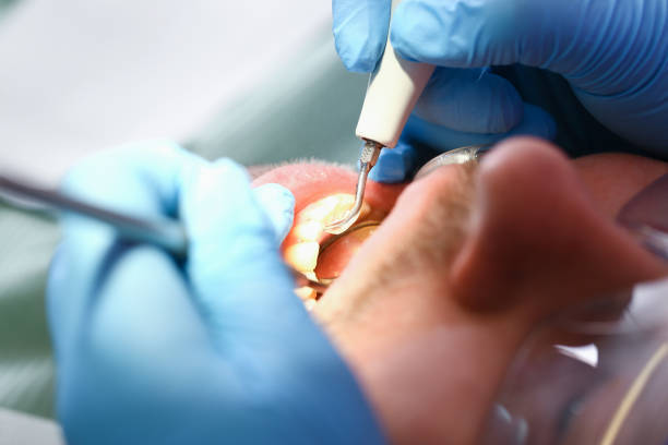 Best Emergency Dental Surgery in St Bernard, OH