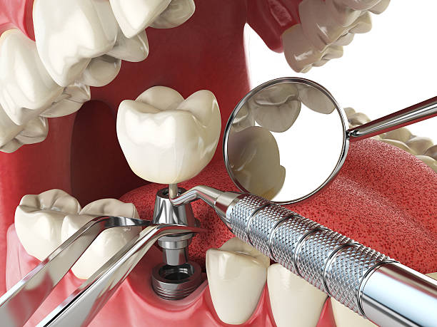 Best Weekend Emergency Dentist in St Bernard, OH